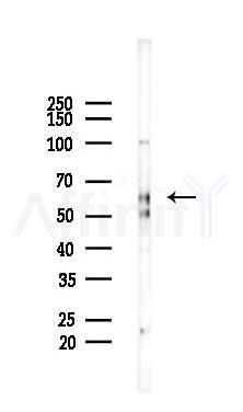 Myeloperoxidase Recombinant Rabbit mAb - Western blot analysis of lysates from Mouse lung, using Myeloperoxidase Recombinant Rabbit mAb at 1/1000 dilution.