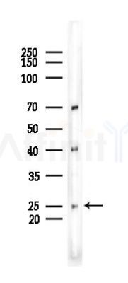 RAB7B Recombinant Rabbit mAb - Western blot analysis of lysates from Mouse testis, using RAB7B Recombinant Rabbit mAb at 1/1000 dilution.