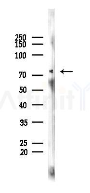 Phospho-STAT3 (Tyr705) Recombinant Rabbit mAb - Western blot analysis of lysates from B16F10-LUC cells(heat-shock 45min treatment), using Phospho-STAT3 (Tyr705) Recombinant Rabbit mAb at 1/1000 dilution.