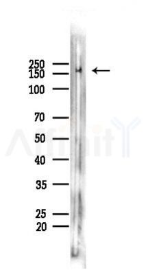 APC  Recombinant Rabbit mAb - Western blot analysis of lysates from Mouse brain, using APC  Recombinant Rabbit mAb at 1/1000 dilution.