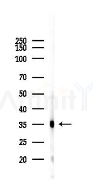 Caspase 3 Recombinant Rabbit mAb - Western blot analysis of lysates from K562 cells(heat-shock 45min treatment), using Caspase 3 Recombinant Rabbit mAb at 1/1000 dilution.