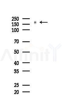 Phospho-EGFR (Tyr1068) Recombinant Rabbit mAb - Western blot analysis of lysates from HUVEC cells(UV 30min treatment), using Phospho-EGFR (Tyr1068) Recombinant Rabbit mAb at 1/1000 dilution.