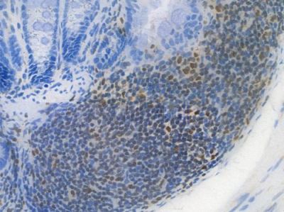 SPI1 Recombinant Rabbit mAb - BF3910 at 1/100 staining Mouse rectal tissue by IHC-P.