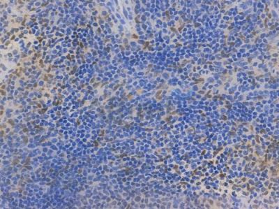SPI1 Recombinant Rabbit mAb - BF3910 at 1/100 staining Mouse spleen tissue by IHC-P.