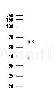 SQSTM1/p62 Recombinant Rabbit mAb - Western blot analysis of lysates from K562 cells(heat-shock 45min treatment), using SQSTM1/p62 Recombinant Rabbit mAb at 1/1000 dilution.