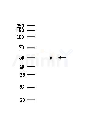 beta Tubulin Recombinant Rabbit mAb - Western blot analysis of lysates from Mouse testis, using beta Tubulin Recombinant Rabbit mAb at 1/1000 dilution.