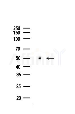 alpha Tubulin Recombinant Rabbit mAb - Western blot analysis of lysates from Mouse testis, using alpha Tubulin Recombinant Rabbit mAb at 1/1000 dilution.