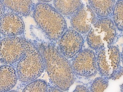 Vinculin Recombinant Rabbit mAb - BF3916 at 1/100 staining Mouse testicular tissue by IHC-P.