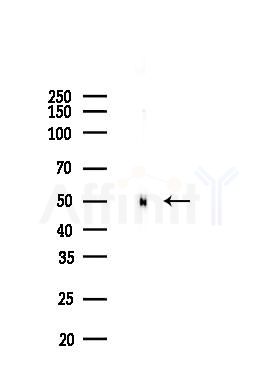 PRAME Recombinant Rabbit mAb - Western blot analysis of lysates from K562 cells(heat-shock 45min treatment), using PRAME Recombinant Rabbit mAb at 1/1000 dilution.