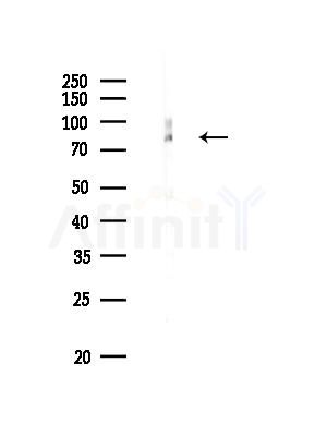 HADHA Recombinant Rabbit mAb - Western blot analysis of lysates from Mouse brain, using HADHA Recombinant Rabbit mAb at 1/1000 dilution.