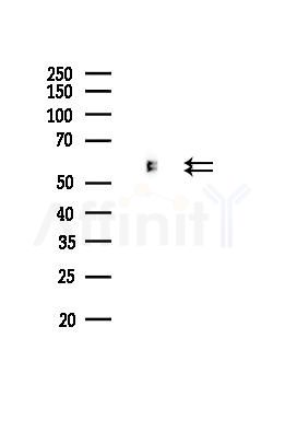 HDAC2 Recombinant Rabbit mAb - Western blot analysis of lysates from Mouse testis, using HDAC2 Recombinant Rabbit mAb at 1/1000 dilution.