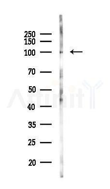 FGA Recombinant Rabbit mAb - Western blot analysis of lysates from Rat testis, using FGA Recombinant Rabbit mAb at 1/1000 dilution.