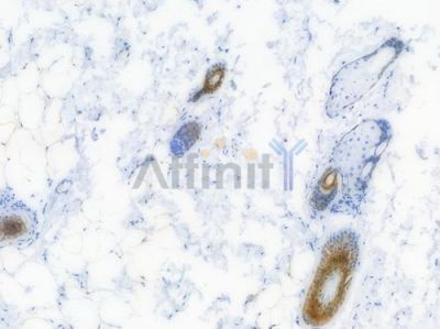 Cytokeratin 6 Recombinant Rabbit mAb - BF3929 at 1/100 staining Rat skin tissue by IHC-P.