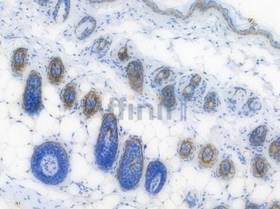 Cytokeratin 6 Recombinant Rabbit mAb - BF3929 at 1/100 staining Mouse skin tissue by IHC-P.