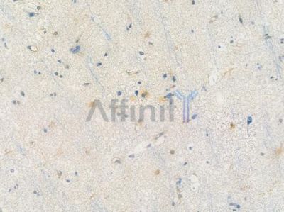 PAK1 Recombinant Rabbit mAb - BF3931 at 1/100 staining Human brain tissue by IHC-P.