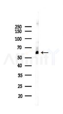 PAK1 Recombinant Rabbit mAb - Western blot analysis of lysates from HUVEC cells(UV 30min treatment), using PAK1 Recombinant Rabbit mAb at 1/1000 dilution.