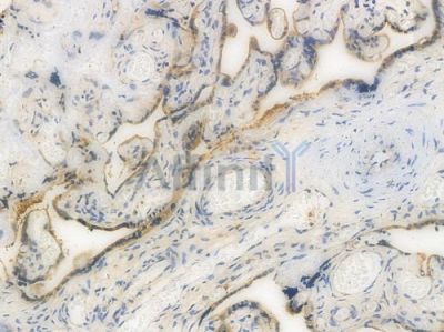 IFNGR1 Recombinant Rabbit mAb - BF3933 at 1/100 staining Human heart tissue by IHC-P.