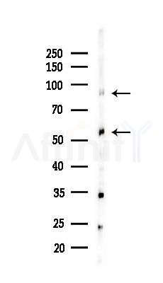 IFNGR1 Recombinant Rabbit mAb - Western blot analysis of lysates from Mouse testis, using IFNGR1 Recombinant Rabbit mAb at 1/1000 dilution.