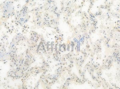 VCP Recombinant Rabbit mAb - BF3935 at 1/100 staining Human lung tissue by IHC-P.
