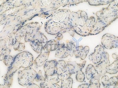 VCP Recombinant Rabbit mAb - BF3935 at 1/100 staining Human placental tissue by IHC-P.
