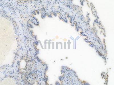 Flotillin 1 Recombinant Rabbit mAb - BF3937 at 1/100 staining Rat lung tissue by IHC-P.