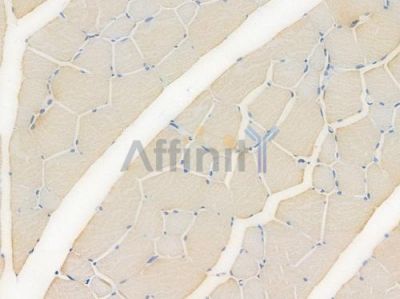 ATP citrate lyase Recombinant Rabbit mAb - BF3939 at 1/100 staining Rat skeletal muscle tissue by IHC-P.