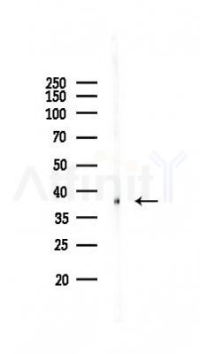 CD79A Recombinant Rabbit mAb - Western blot analysis of lysates from Mouse kidney, using CD79A Recombinant Rabbit mAb at 1/1000 dilution.