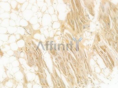 Aspartate Aminotransferase Recombinant Rabbit mAb - BF3941 at 1/100 staining Human heart tissue by IHC-P.