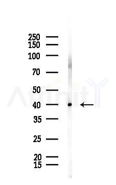 Aspartate Aminotransferase Recombinant Rabbit mAb - Western blot analysis of lysates from Mouse testis, using Aspartate Aminotransferase Recombinant Rabbit mAb at 1/1000 dilution.
