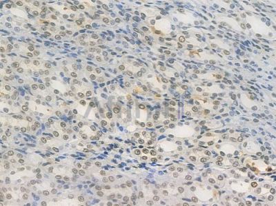 DKC1 Recombinant Rabbit mAb - BF3942 at 1/100 staining Rat renal tissue by IHC-P.