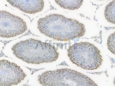 DKC1 Recombinant Rabbit mAb - BF3942 at 1/100 staining Rat testicular tissue by IHC-P.