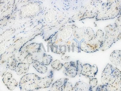 DKC1 Recombinant Rabbit mAb - BF3942 at 1/100 staining Human placental tissue by IHC-P.