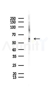 DKC1 Recombinant Rabbit mAb - Western blot analysis of lysates from Rat testis, using DKC1 Recombinant Rabbit mAb at 1/1000 dilution.