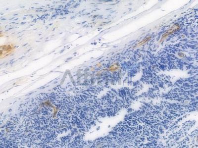 VWF Recombinant Rabbit mAb - BF3943 at 1/100 staining Human tonsil tissue by IHC-P.
