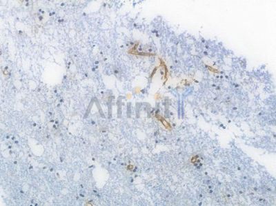 VWF Recombinant Rabbit mAb - BF3943 at 1/100 staining Human brain tissue by IHC-P.