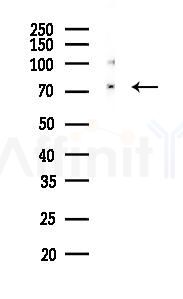 VWF Recombinant Rabbit mAb - Western blot analysis of lysates from PC12 cells(LPS 4h treatment), using VWF Recombinant Rabbit mAb at 1/1000 dilution.