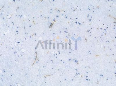 MDR1 Recombinant Rabbit mAb - BF3944 at 1/100 staining Human brain tissue by IHC-P.