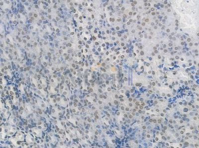 EWSR1 Recombinant Rabbit mAb - BF3945 at 1/100 staining Mouse renal tissue by IHC-P.