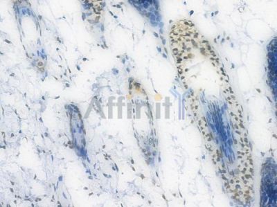 EWSR1 Recombinant Rabbit mAb - BF3945 at 1/100 staining Mouse skin tissue by IHC-P.