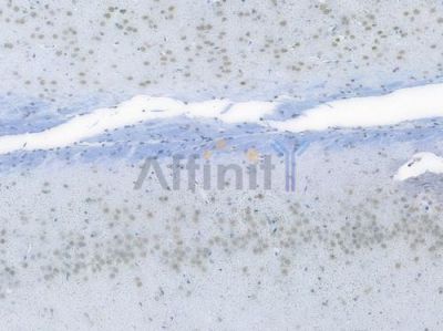 EWSR1 Recombinant Rabbit mAb - BF3945 at 1/100 staining Rat brain tissue by IHC-P.