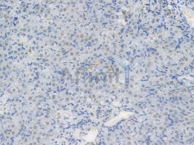 EWSR1 Recombinant Rabbit mAb - BF3945 at 1/100 staining Rat ovarian tissue by IHC-P.