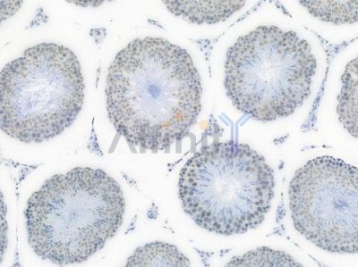 EWSR1 Recombinant Rabbit mAb - BF3945 at 1/100 staining Rat testicular tissue by IHC-P.