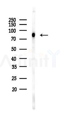 EWSR1 Recombinant Rabbit mAb - Western blot analysis of lysates from Hela cells(heat-shock 45min treatment), using EWSR1 Recombinant Rabbit mAb at 1/1000 dilution.