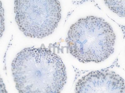 TOP1 Recombinant Rabbit mAb - BF3946 at 1/100 staining Rat testicular tissue by IHC-P.