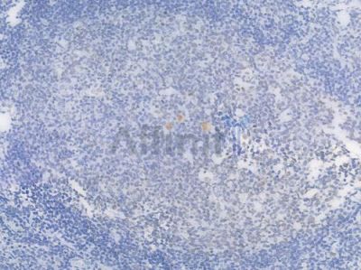 TOP1 Recombinant Rabbit mAb - BF3946 at 1/100 staining Human tonsil tissue by IHC-P.