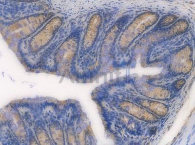 LOX Recombinant Rabbit mAb - BF3947 at 1/100 staining Mouse rectal tissue by IHC-P.
