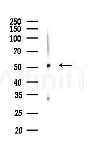 LOX Recombinant Rabbit mAb - Western blot analysis of lysates from Mouse lung, using LOX Recombinant Rabbit mAb at 1/1000 dilution.