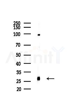 Presenilin 1 Recombinant Rabbit mAb - Western blot analysis of lysates from Mouse testis, using Presenilin 1 Recombinant Rabbit mAb at 1/1000 dilution.