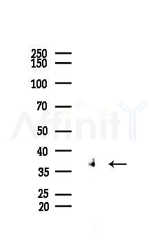 Phospho-ERK1/2 (Thr202/Thr185) Recombinant Rabbit mAb - Western blot analysis of lysates from Hela cells(heat-shock 45min treatment), using Phospho-ERK1/2 (Thr202/Thr185) Recombinant Rabbit mAb at 1/1000 dilution.