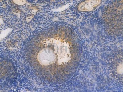 Integrin  alpha V Recombinant Rabbit mAb - BF3951 at 1/100 staining Mouse ovarian tissue by IHC-P.